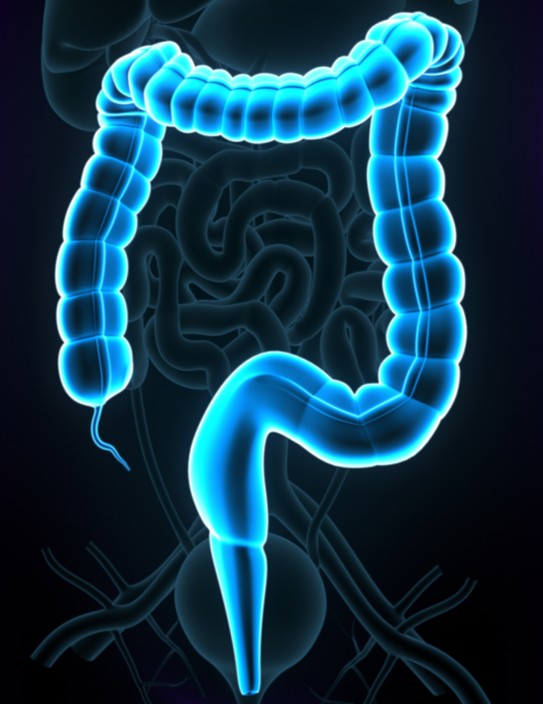 Abstract of colorectal system