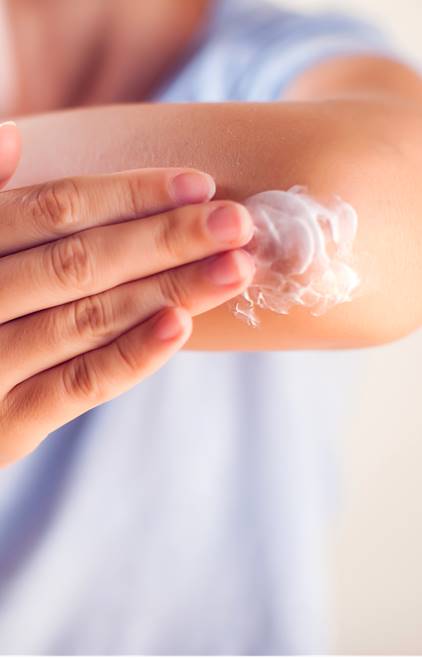 Topical cream being applied to elbow